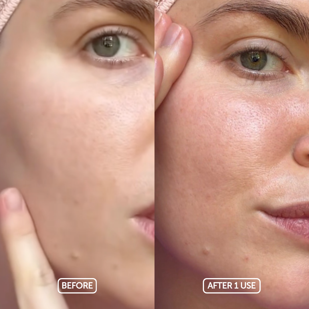 Before and after comparison of a woman's face with visible skin improvement using cosmette skincare products.