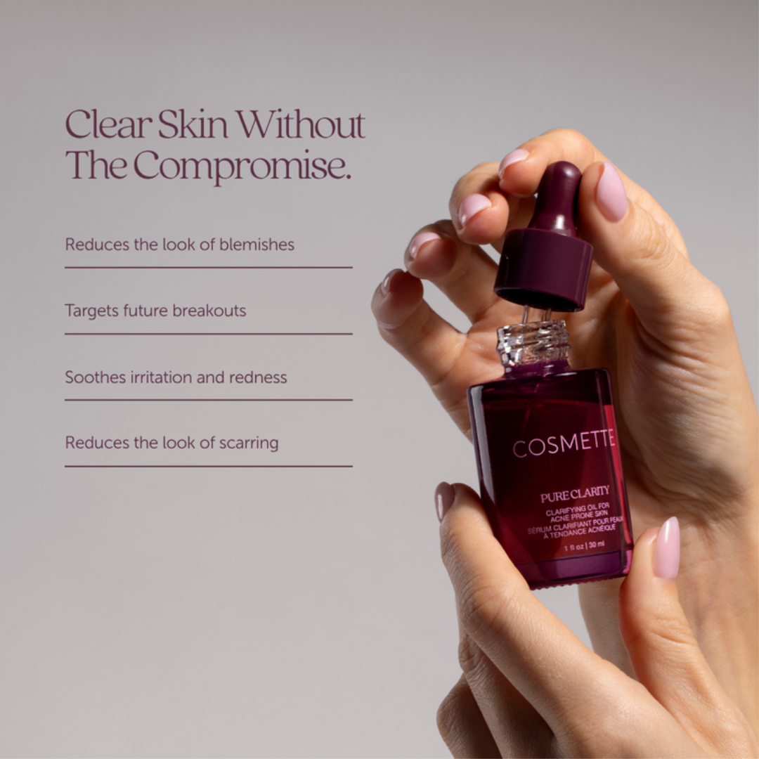 Hand holding a Cosmette skincare product with benefits listed: reduces blemishes, targets  future breakouts, soothes irritation and redness, reduces look of scarring