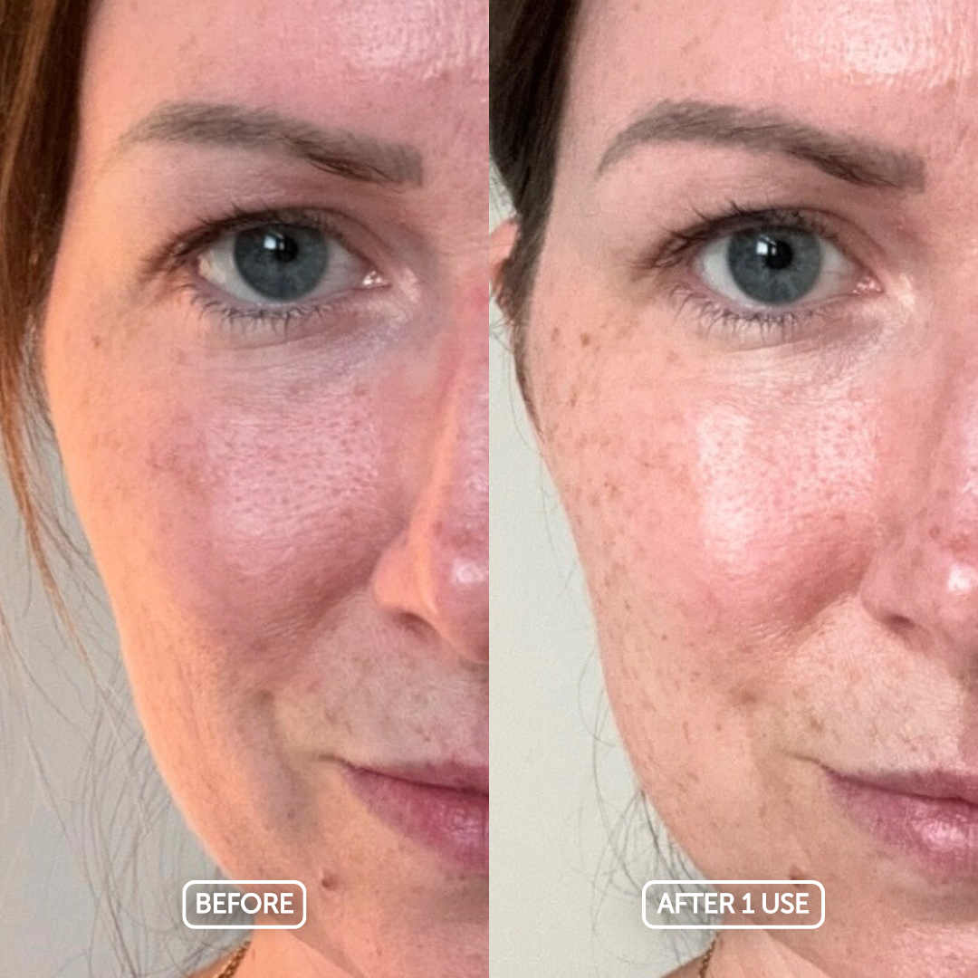 Before and after comparison of a woman's face with visible skin improvement using the timeless hydration