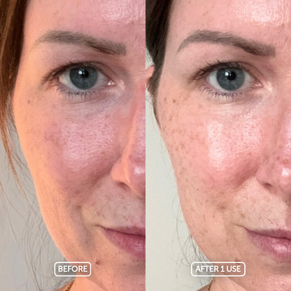 Before and after comparison of a woman's face with visible skin improvement using the timeless hydration